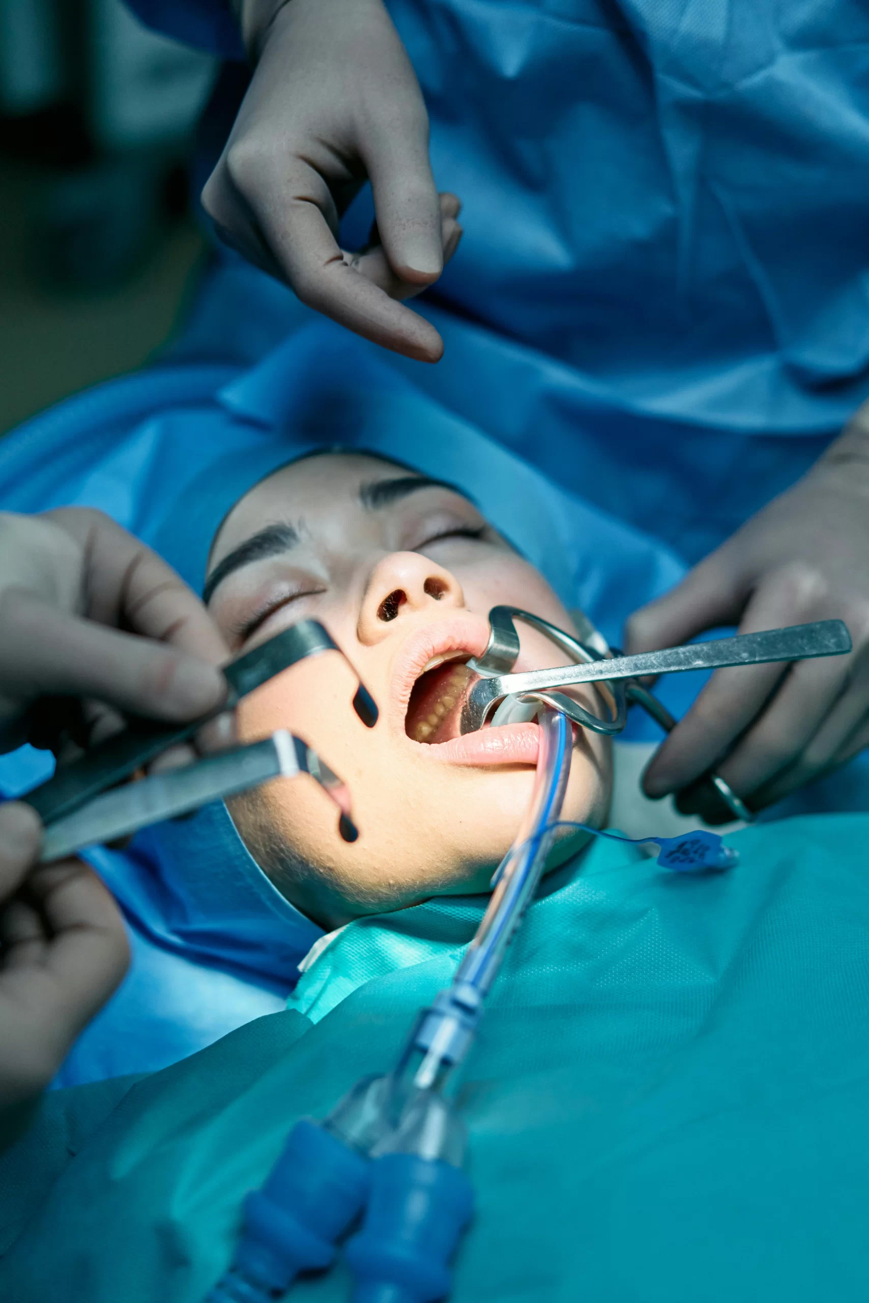 A lady having her oral surgery.